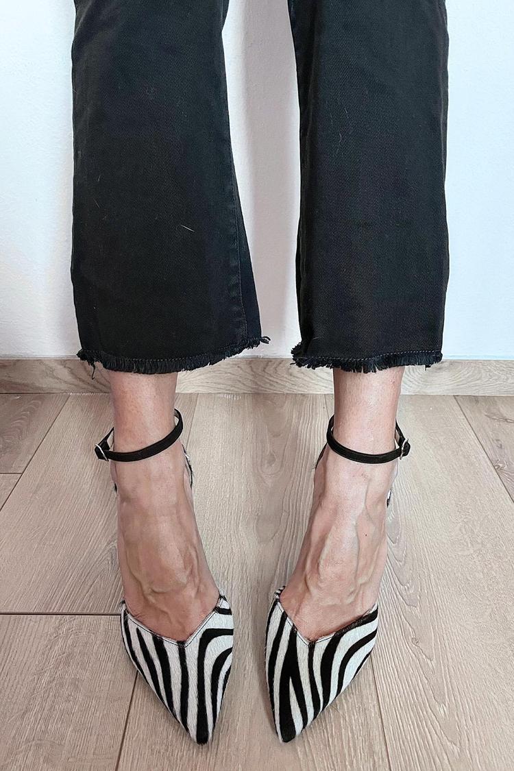 LORELEI | ZEBRA PRINT PUMPS WITH ANKLE STRAP